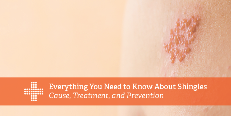 Shingles Inferior Patient Plus Urgent Care | Everything You Need to Know About Shingles